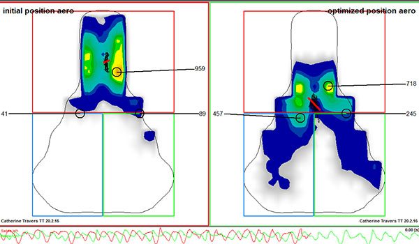 Saddle pressure areas